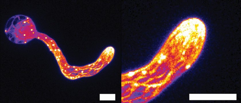 Microscopie-opname van het celskelet van Phytophthora tijdens penetratie van een gastheer laat de zelf-scherpende structuur zien. Links: opname van de gehele cel, rechts: close-up van de aanvals-structuur. Schaalbalk geeft een afstand van 5 micrometer weer Microscopie-opname van het celskelet van Phytophthora tijdens penetratie van een gastheer laat de zelf-scherpende structuur zien. Links: opname van de gehele cel, rechts: close-up van de aanvals-structuur. Schaalbalk geeft een afstand van 5 micrometer weer