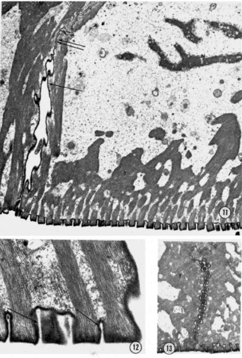 Electron microscope image of a stained section of a toe pad of H. cinera (Ernst, 1973).