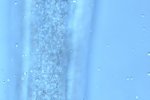 Picture shows punctuated cuticle of a Paracyathlaimus intermedius, a closely related species (picture made by Hanny van Megen). 