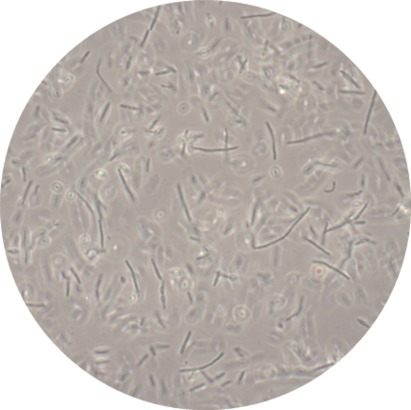 Foto van Clostridium beijerinckii NCIMB 8052 na 24 uur fermentatie, foto Mamou Diallo (FBR) Foto van Clostridium beijerinckii NCIMB 8052 na 24 uur fermentatie, foto Mamou Diallo (FBR)