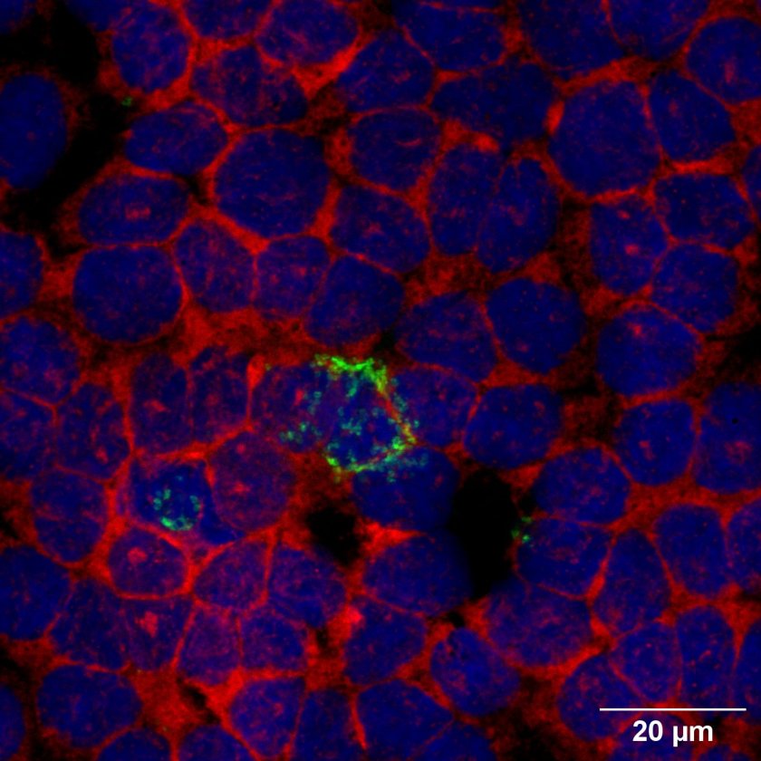 Highlighted in green, the presence of the Chlamydia bacteria. Highlighted in green, the presence of the Chlamydia bacteria.